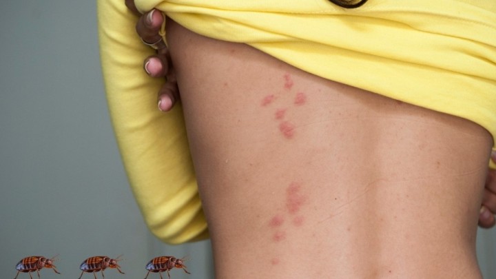 Najezda stjenica i u Hrvatskoj: Kakvi su ovo kukci, jesu li opasni i kako se zaštiti?