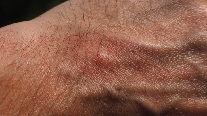 Zagreb opet preplavile "prozirne bubice": Grizu i neugodne su, a sve ih je više