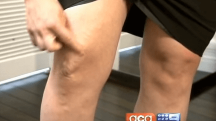 Stručnjaci: Ako imate proširene vene, mačka nije dobar odabir za kućnog ljubimca