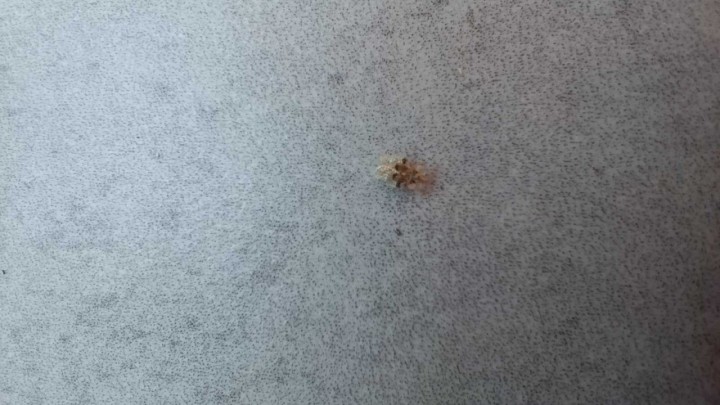 Stjenice su sve češća pojava u Zagrebu: Provjerite jesu li opasne po zdravlje